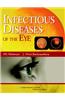 Infectious Diseases of the Eyes