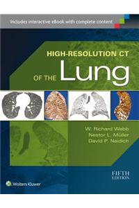 High-Resolution CT of the Lung
