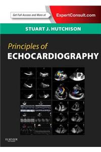 Principles of Echocardiography and Intracardiac Echocardiography