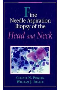 Fine Needle Aspiration Biopsy of the Head and Neck