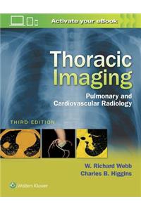 Thoracic Imaging: Pulmonary and Cardiovascular Radiology