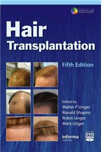 Hair Transplantation