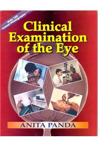 Clinical Examination of Eye