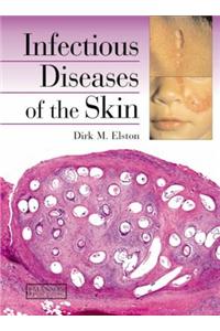 Infectious Diseases of the Skin