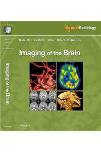Imaging of the Brain