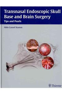 Transnasal Endoscopic Skull Base and Brain Surgery: Tips and Pearls