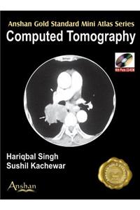 Computed Tomography [With Mini CDROM]
