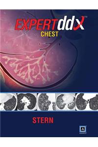 EXPERTddx: Chest