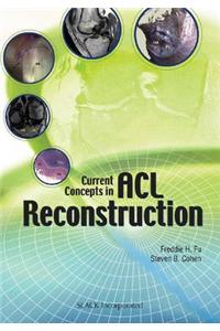 Current Concepts in ACL Reconstruction