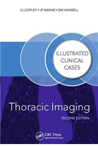 Thoracic Imaging: Illustrated Clinical Cases, Second Edition