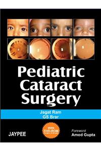 Pediatric Cataract Surgery (with DVD-ROM) 