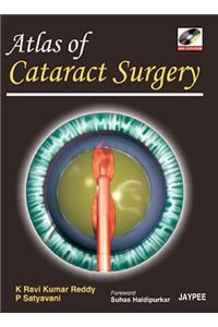 Atlas of Cataract Surgery (with DVD-ROM)