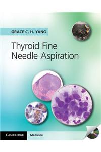 Thyroid Fine Needle Aspiration