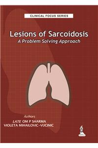 Clinical Focus Series: Lesions of Sarcoidosis