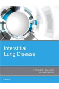 Interstitial Lung Disease