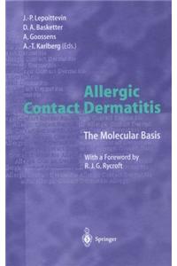 ALLERGIC CONTACT DERMATITIS