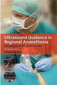 Ultrasound Guidance in Regional Anaesthesia: Principles and Practical Implementation