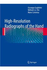 High-Resolution Radiographs of the Hand