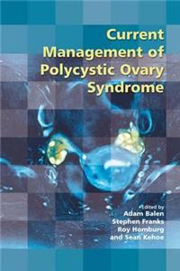 Current Management of Polycystic Ovary Syndrome