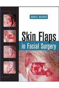 Skin Flaps in Facial Surgery