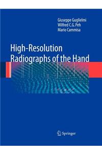 High-Resolution Radiographs of the Hand