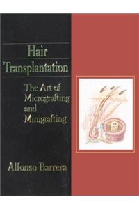Hair Transplantation: The Art of Micrografting and Minigrafting