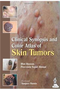 Clinical Synopsis and Color Atlas of Skin Tumors