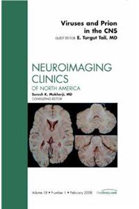 Viruses and Prions in the CNS, an Issue of Neuroimaging Clinics