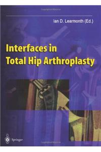 Interfaces in Total Hip Arthroplasty