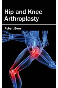Hip and Knee Arthroplasty