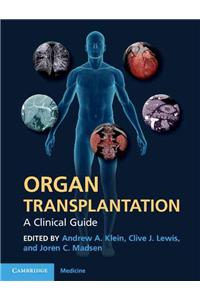 Organ Transplantation