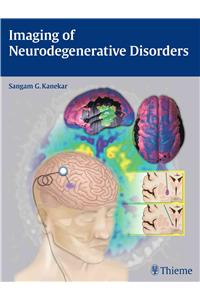 Imaging of Neurodegenerative Disorders