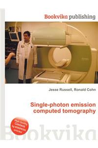Single-Photon Emission Computed Tomography