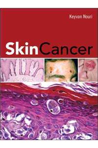 Skin Cancer