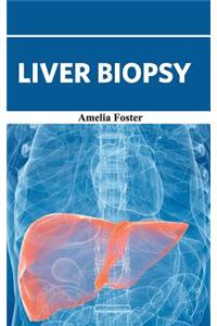 Liver Biopsy