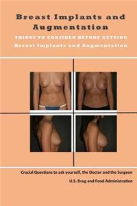 Breast Implants and Augmentation: Things to Consider Before Getting Breast Implants & Breast Augmentation