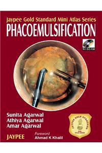 Jaypee Gold Standard Mini Atlas Series Phacoemulsification with DVD ROM