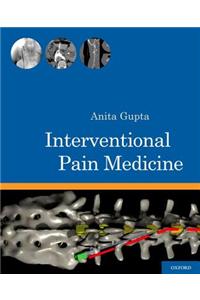 Interventional Pain Medicine