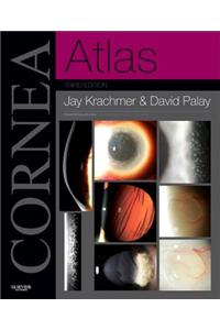 Cornea Atlas: Expert Consult - Online and Print