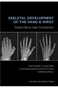 Skeletal Development of the Hand & Wrist