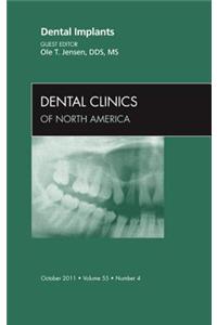 Dental Implants, an Issue of Dental Clinics