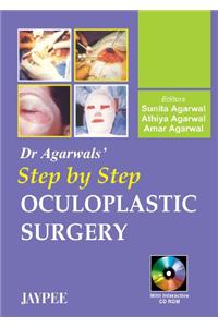 Dr. Agarwals Step by Step Oculoplastic Surgery