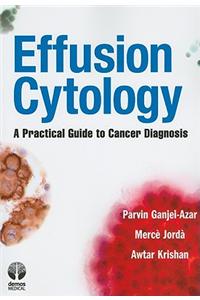 Effusion Cytology: A Practical Guide to Cancer Diagnosis