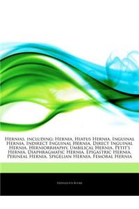 Articles on Hernias, Including: Hernia, Hiatus Hernia, Inguinal Hernia, Indirect Inguinal Hernia, Direct Inguinal Hernia, Herniorrhaphy, Umbilical Her