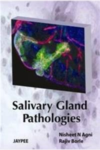 Salivary Gland Pathologies