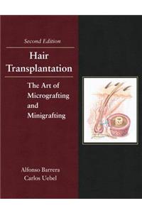 Hair Transplantation