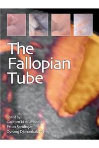 Fallopian Tube