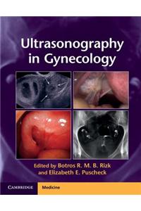Ultrasonography in Gynecology