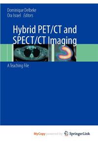 Hybrid Pet/CT and Spect/CT Imaging