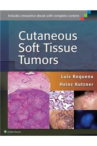 Cutaneous Soft Tissue Tumors